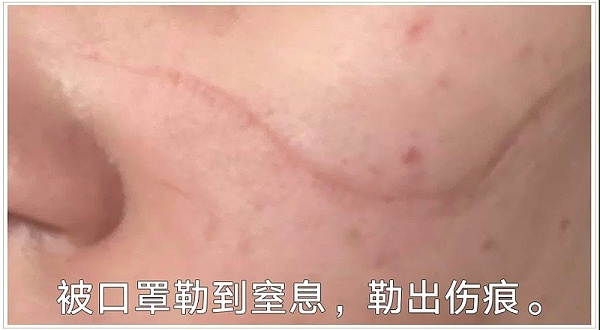 口罩脸